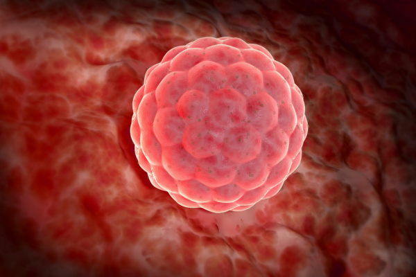 Blastocyst Transfer Considerations